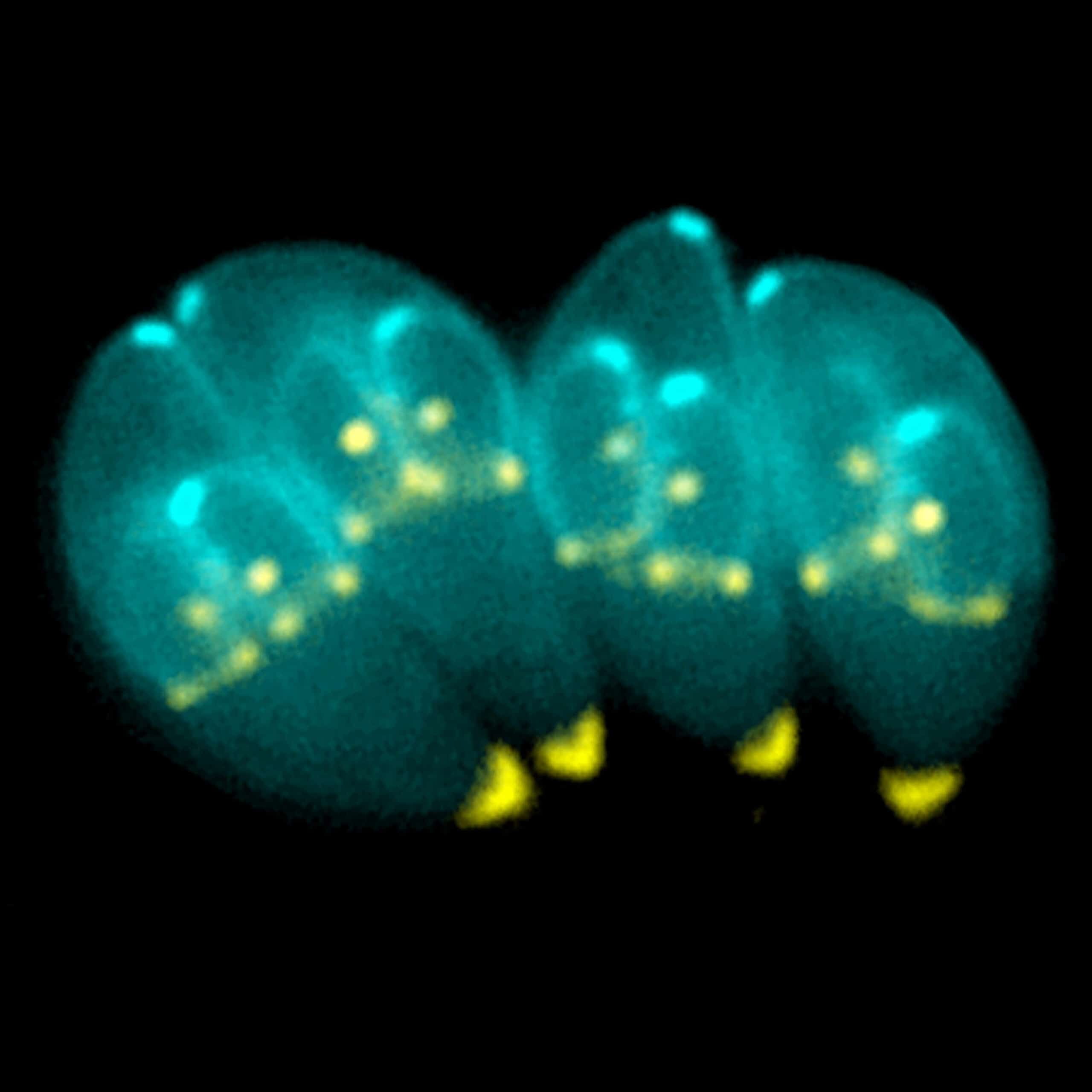 toxoplasma